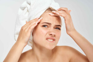 Understanding female adult acne and hormones. Care and treatment endocrinologist Gerald V. Burke MD, Voorhees, NJ