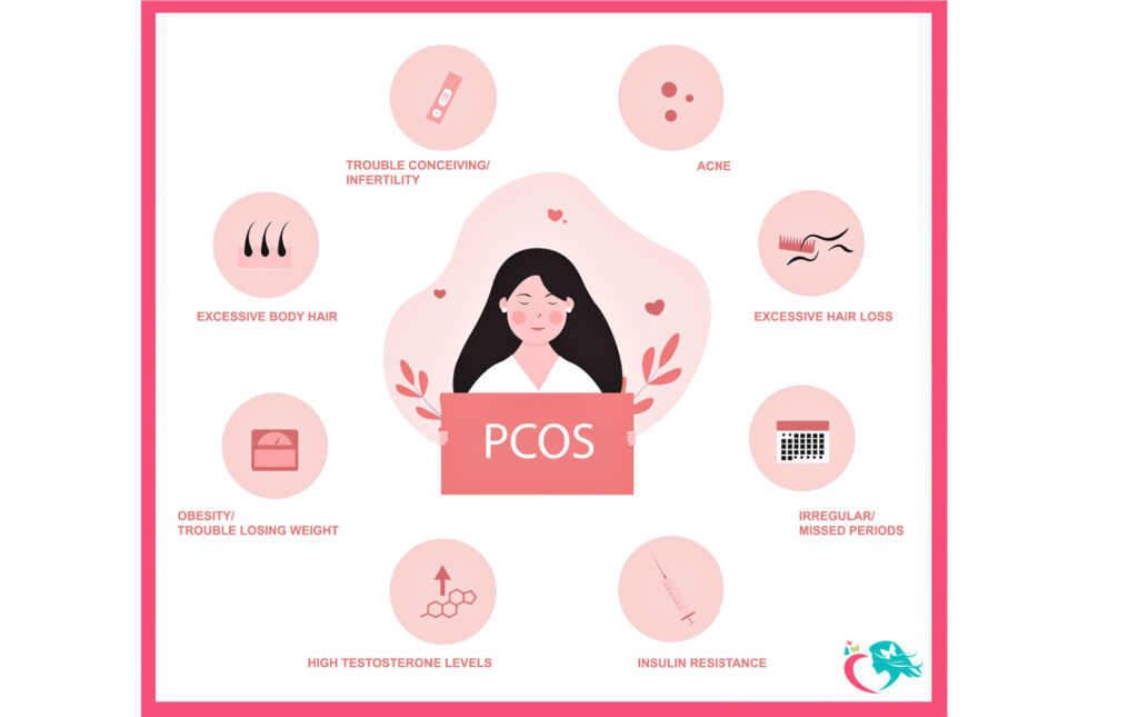 Polycystic Ovarian Syndrome (PCOS) is one of the most misunderstood and, consequently, mistreated disease. Learn about symptoms and treatment. Gerald V. Burke, MD Voorhees NJ
